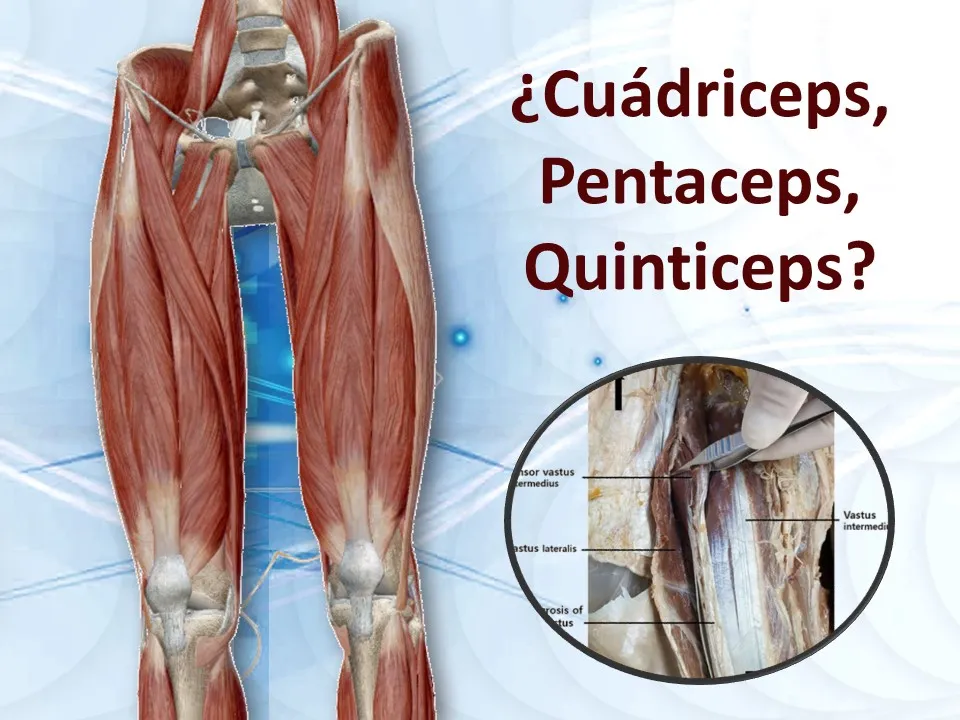 Cuádriceps, ¿Ahora Pentaceps o Quiticeps? Descubriendo el Tensor Vasto Intermedio: El Futuro del Músculo Cuádriceps